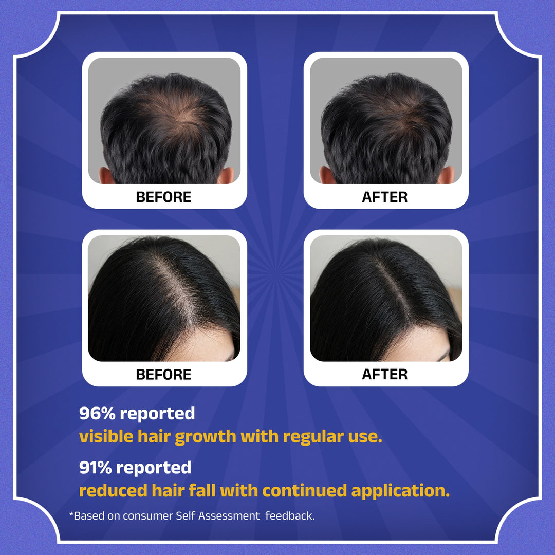 Rockstar Advanced Hair Growth Serum