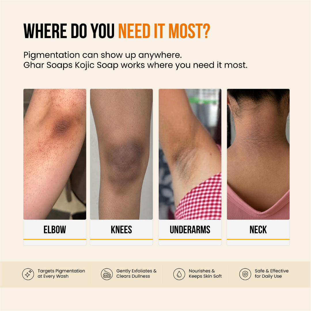 Kojic Acid Soap for De-Pigmentation & Dark Spot Reduction